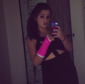 party dress with a broken wrist 